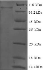 Glucokinase regulatory protein (GCKR), human, recombinant