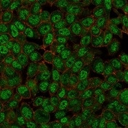 Anti-ZMYM3, clone PCRP-ZMYM3-2F10