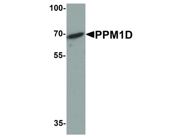 Anti-PPM1D