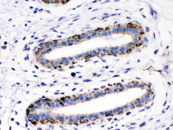 Anti-ASPH / Aspartate Beta Hydroxylase