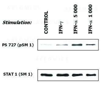 Anti-STAT1 Monoclonal Antibody (Clone:SM1)
