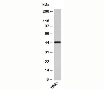 Anti-TRH Receptor