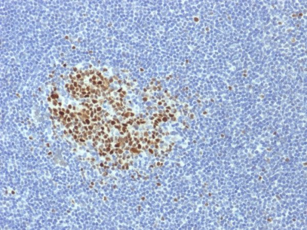 Anti-Bcl-6 (Follicular Lymphoma Marker), clone BCL6/1718