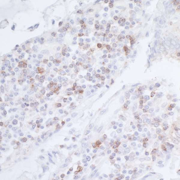 Anti-CD96 Recombinant Monoclonal