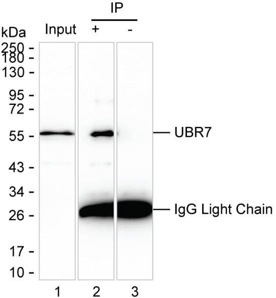 Anti-UBR7