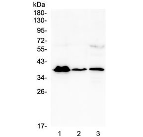 Anti-MR1 / MHC class I related protein 1