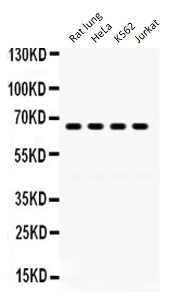 Anti-GRK6