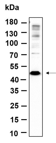 Anti-Recombinant Methionyl Aminopeptidase 1, clone 5B11