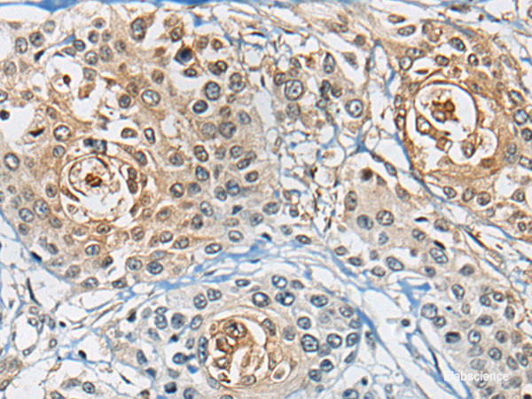 Anti-CD8A