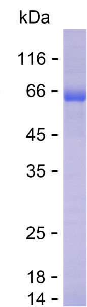 Recombinant Human HIF1AN Protein