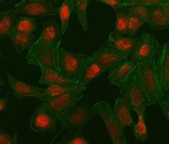 Anti-Interferon regulatory factor 5 / IRF5