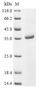 Neurofilament light polypeptide (NEFL), partial, swine, recombinant