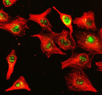 Anti-NUP85 / Nuclear pore complex protein Nup85