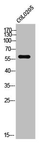 Anti-TCEB3C