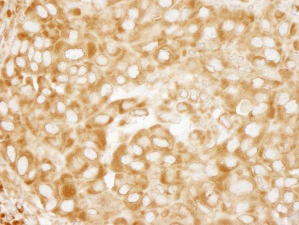 Anti-RPL7 (IHC)