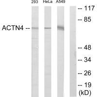 Anti-ACTN1/ACTN2/ACTN3/ACTN4