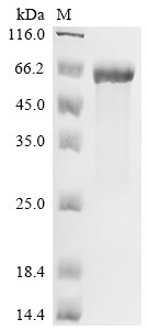 Urease subunit beta (ureB), Helicobacter pylori, recombinant