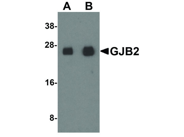 Anti-GJB2