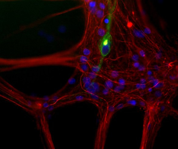 Anti-Neurofilament NF-L