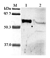 Anti-ANGPTL6 (human)