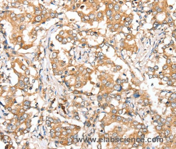 Anti-SIRT4