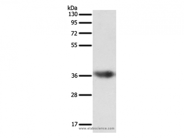 Anti-SULT1E1