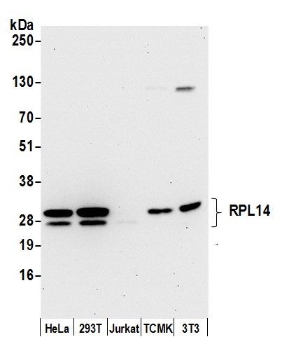 Anti-RPL14/Ribosomal Protein L14