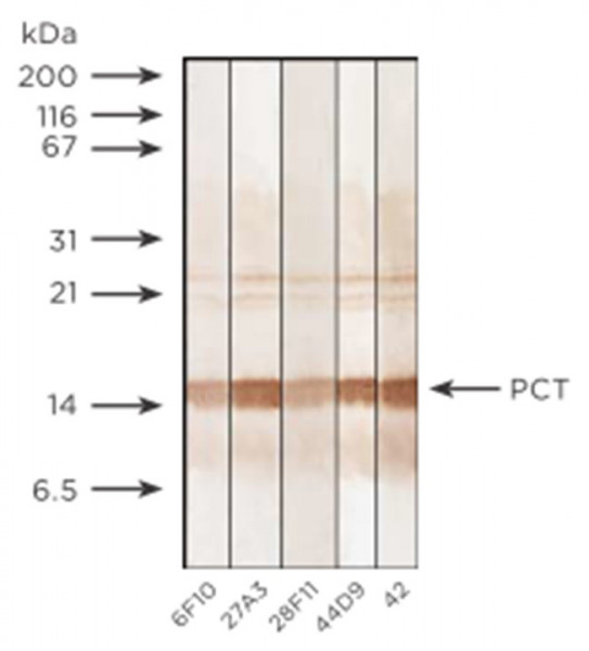 Anti-Procalcitonin, clone 42