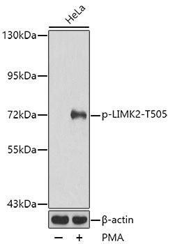 Anti-phospho-LIMK2-T505