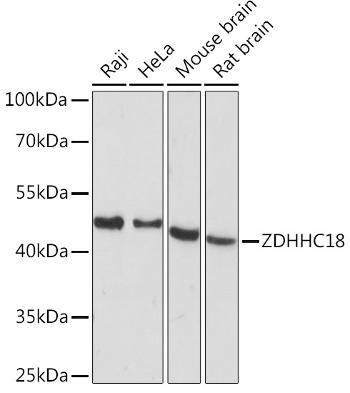 Anti-ZDHHC18