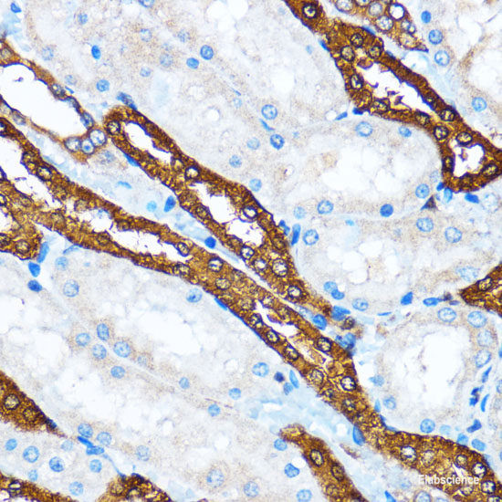 Anti-PI 3 kinase p110 alpha