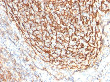 Anti-CD21 (Mature B-Cell &amp; Follicular Dendritic Cell Marker) Monoclonal Antibody (Clone: CR2/2754)