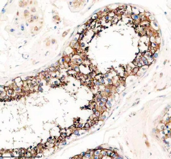 Anti-PRND / Prion-like protein doppel