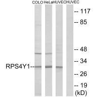 Anti-RPS4Y1