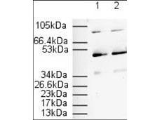 Anti-PPARa, NT (Peroxisome Proliferator Activated Receptor, alpha)