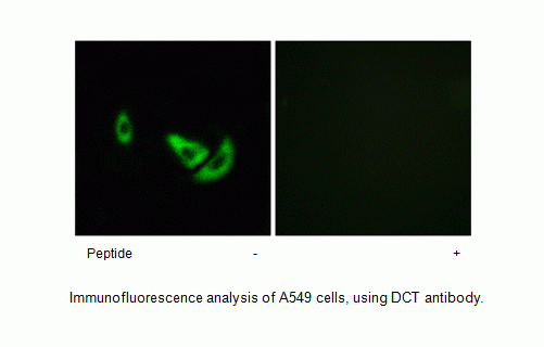 Anti-DCT