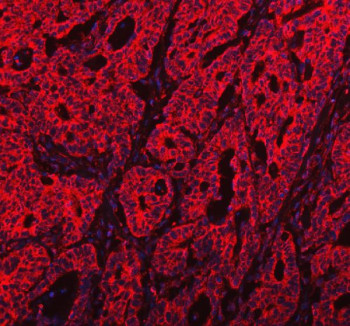 Anti-PKP3 / Plakophilin 3