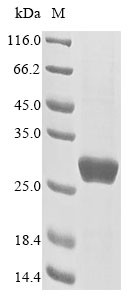 Glutathione S-transferase P (GSTP1), Cricetulus longicaudatus, recombinant