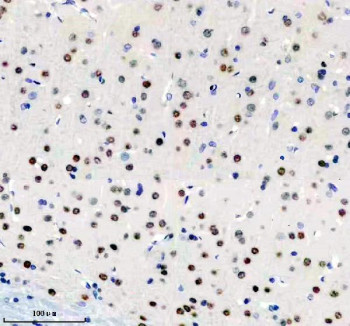 Anti-BIRC3 / Baculoviral IAP repeat-containing protein 2 / cIAP2, clone ABIG-2