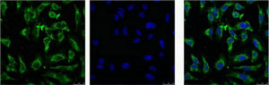 Anti-EFHD1 Monoclonal