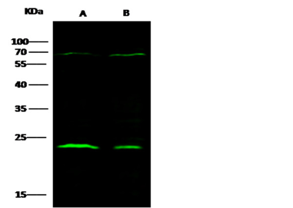 Anti-CTHRC1 Monoclonal Recombinant Antibody