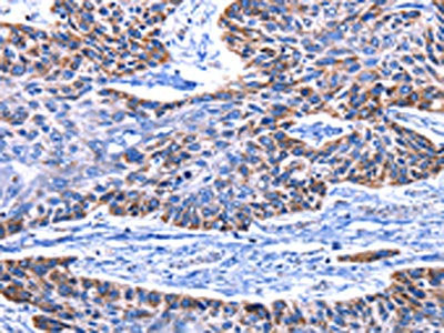 Anti-IGF2BP2