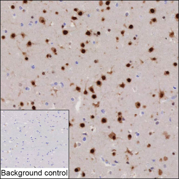 Anti-ELAVL3