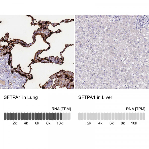 Anti-SFTPA1