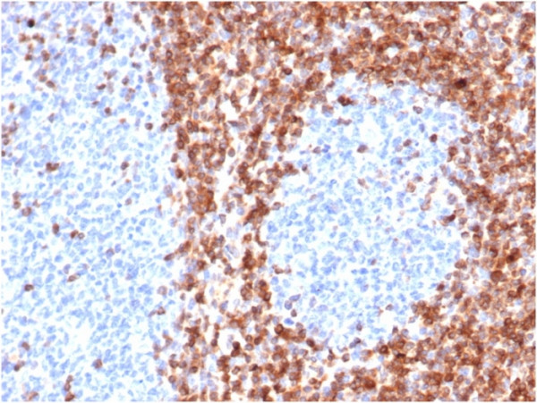 Anti-Bcl-2 (Apoptosis &amp; Follicular Lymphoma Marker), recombinant antibody, clone BCL2/6426R