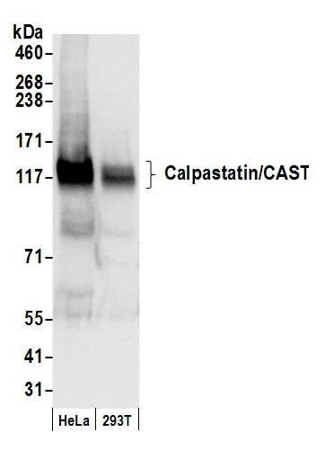 Anti-Calpastatin/CAST