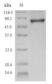 Nicotinate phosphoribosyltransferase (NAPRT), partial, human, recombinant