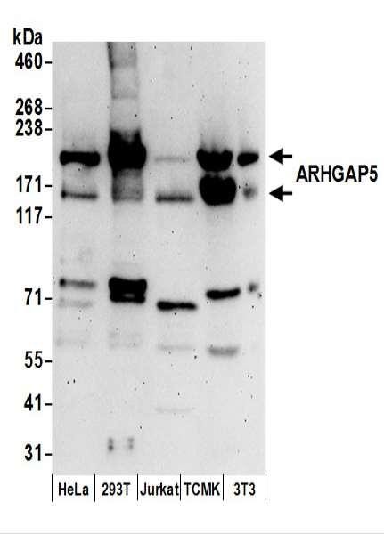 Anti-ARHGAP5