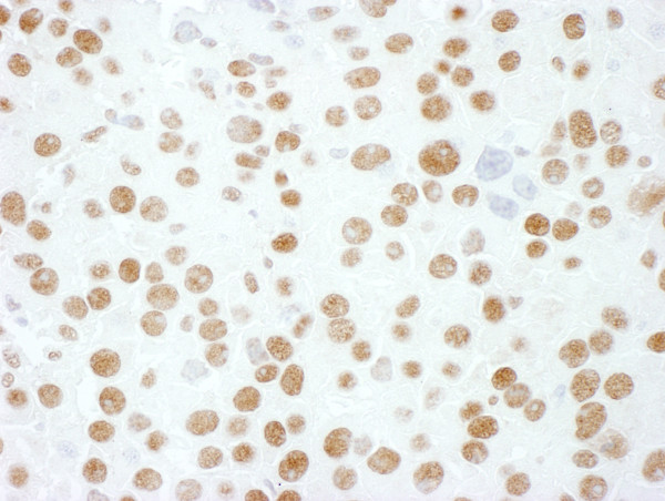 Anti-hnRNP M3/4