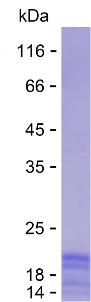 Recombinant Human SRI Protein